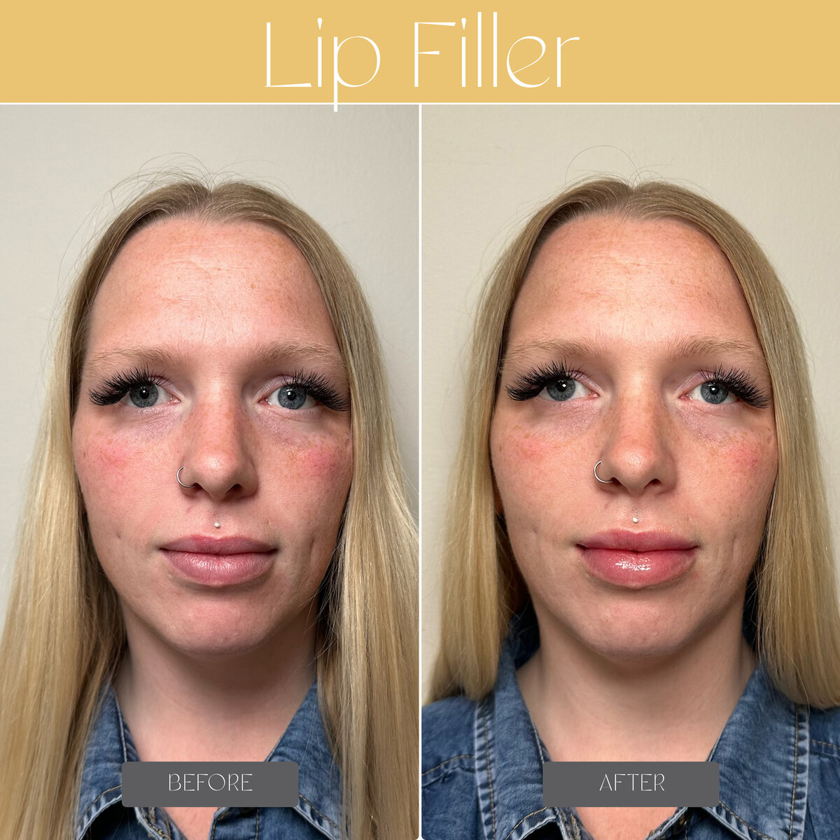 LEMONDROP AESTHETICS BEFORE AND AFTER copy