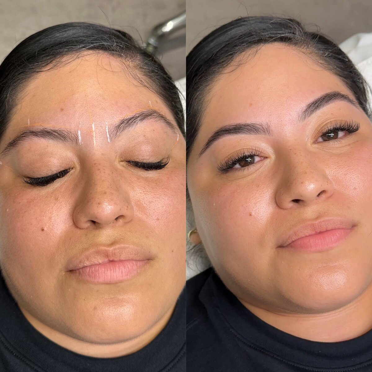 Eyebrow B&A 2