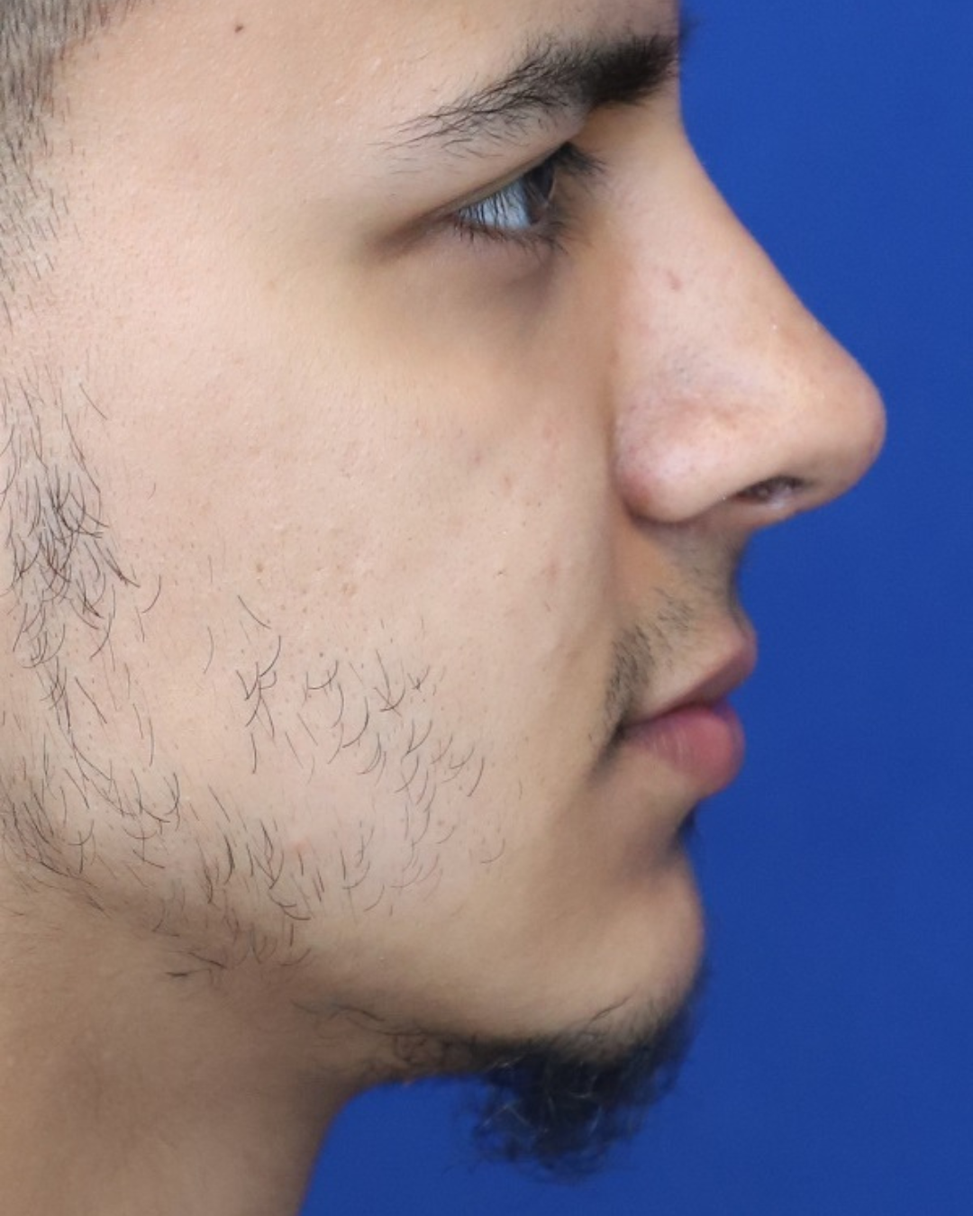 27
