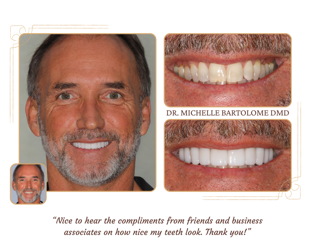 Smile Makeover (1)