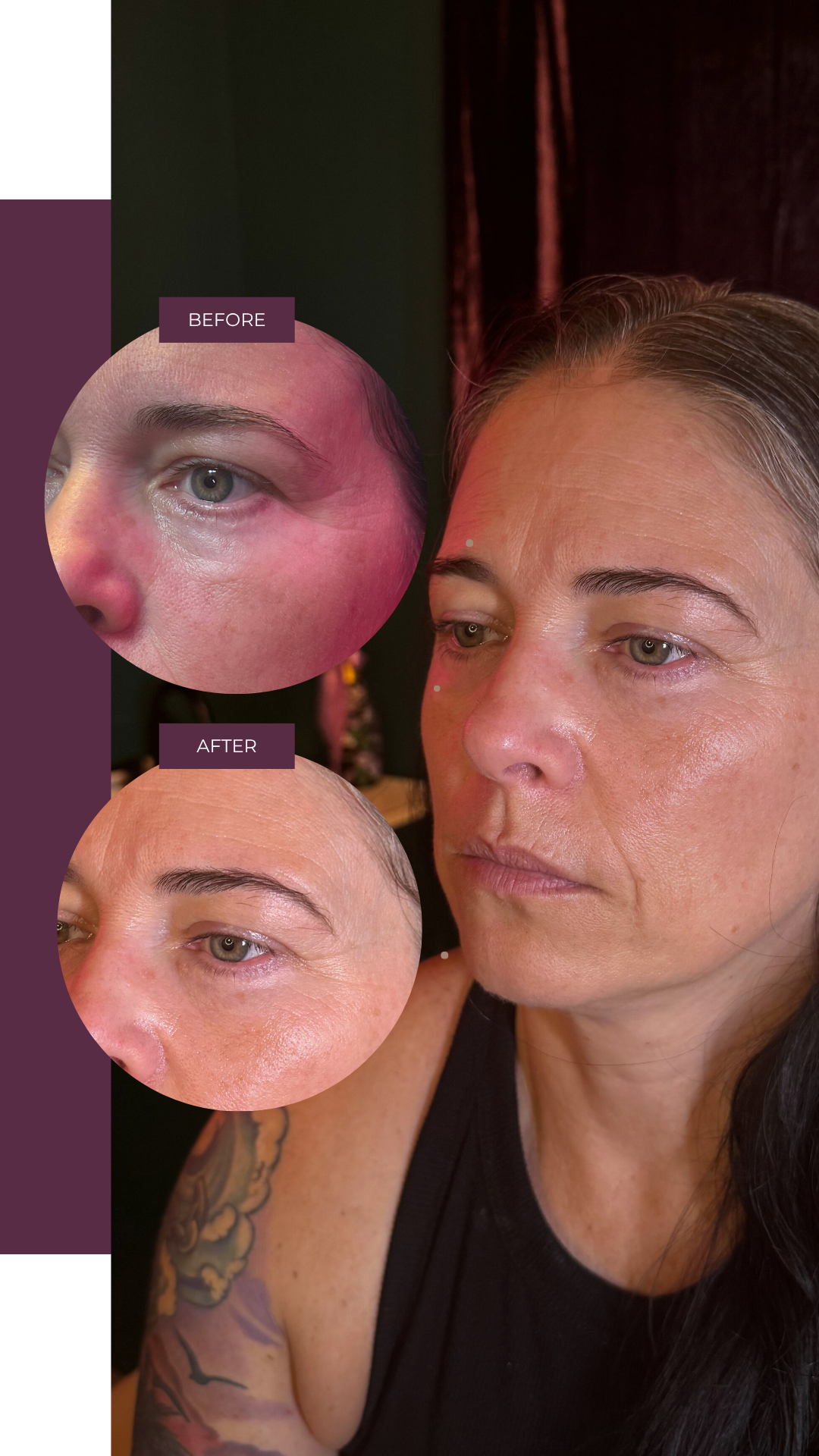 Copy of Before and Afters (Portrait Size).png 1