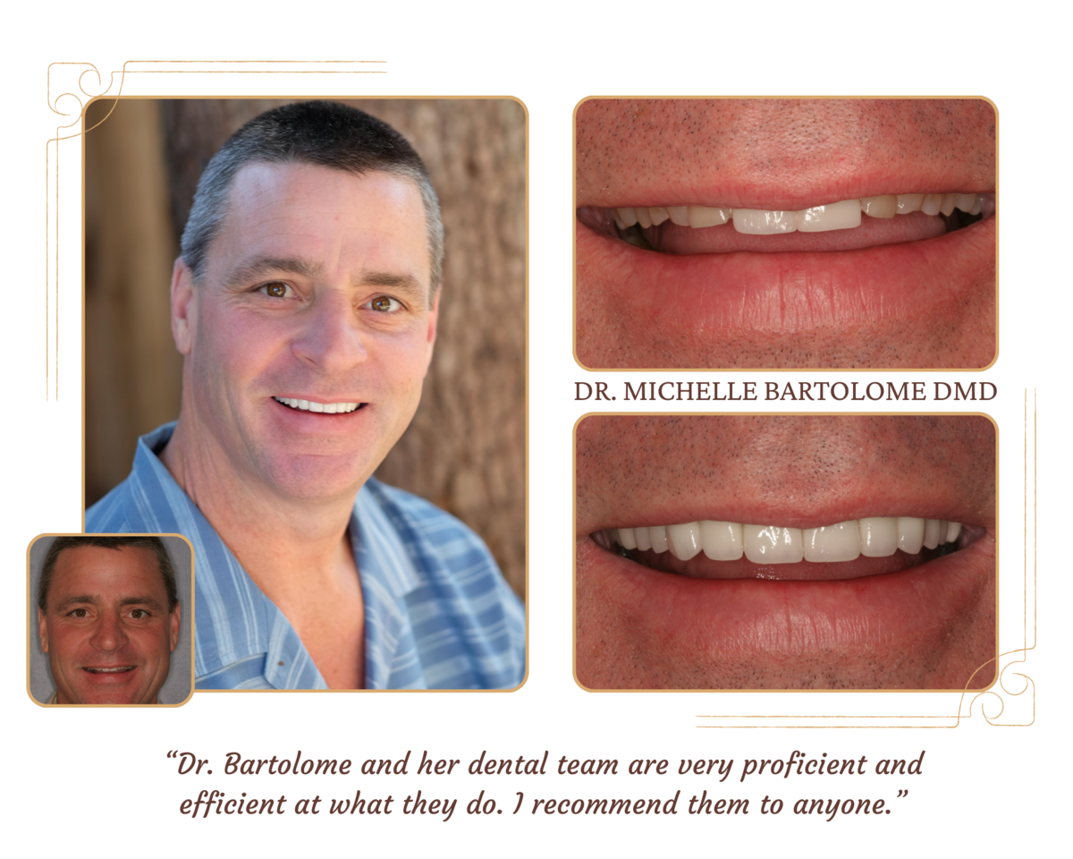 Smile Makeover (4)