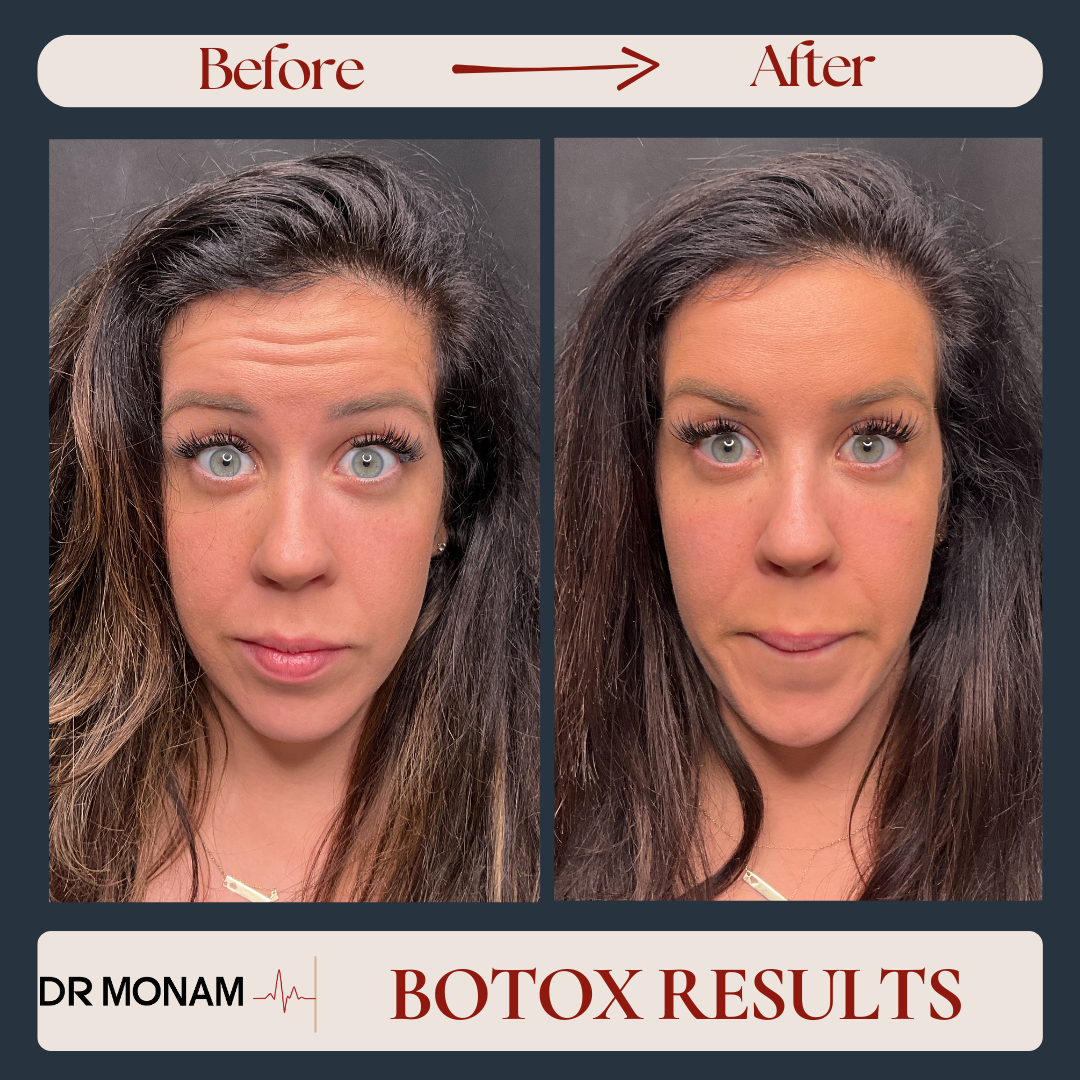 Neutral Before and After Instagram Post-3