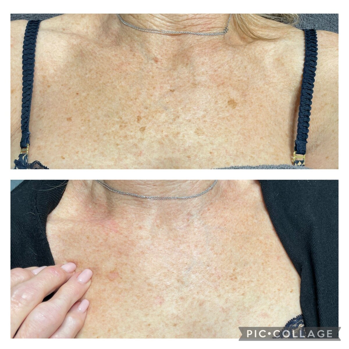 antiwrinkle injections in norwich based clinic aesthetic practitioner