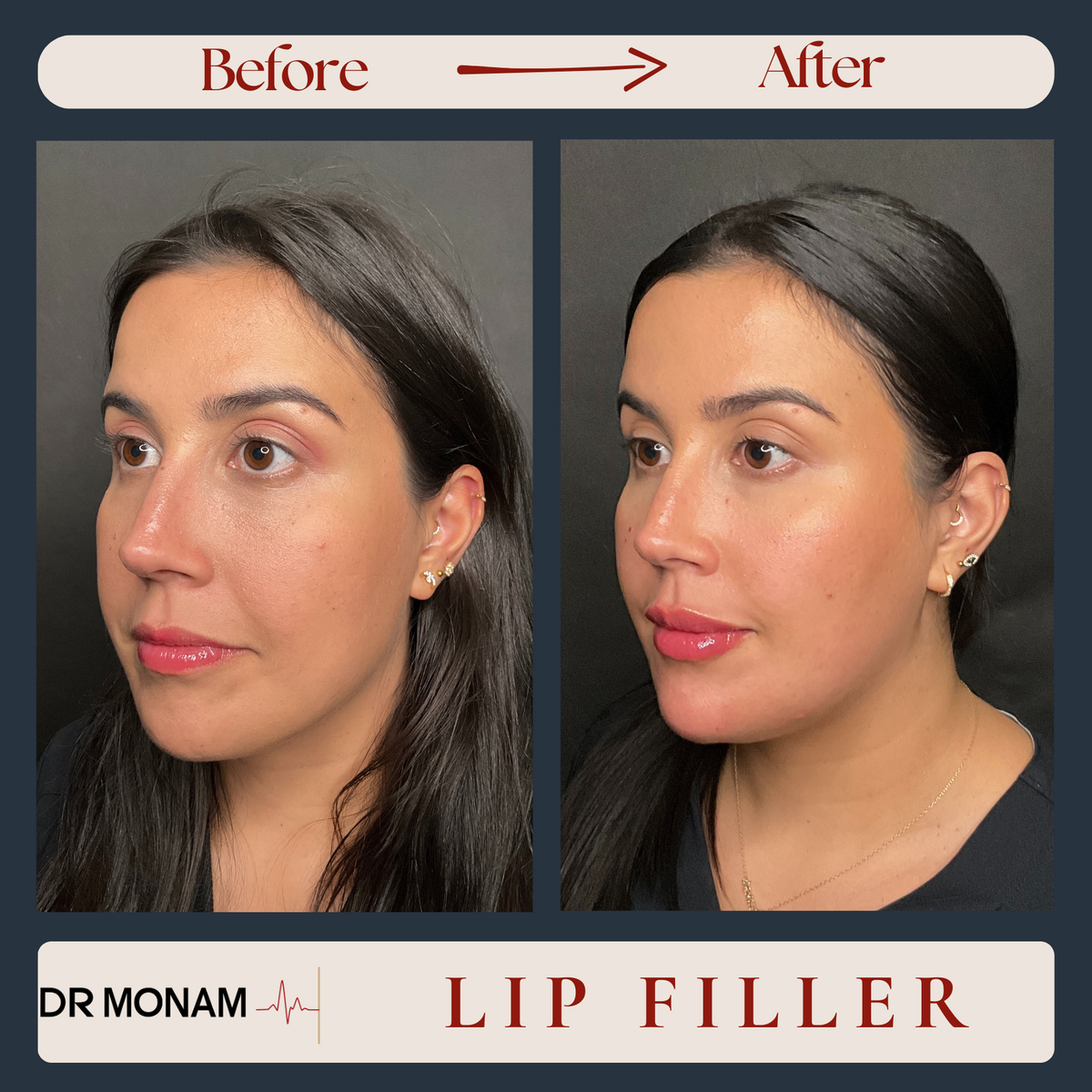 Neutral Before and After Instagram Post-14