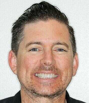 Kirkland picture after veneers
