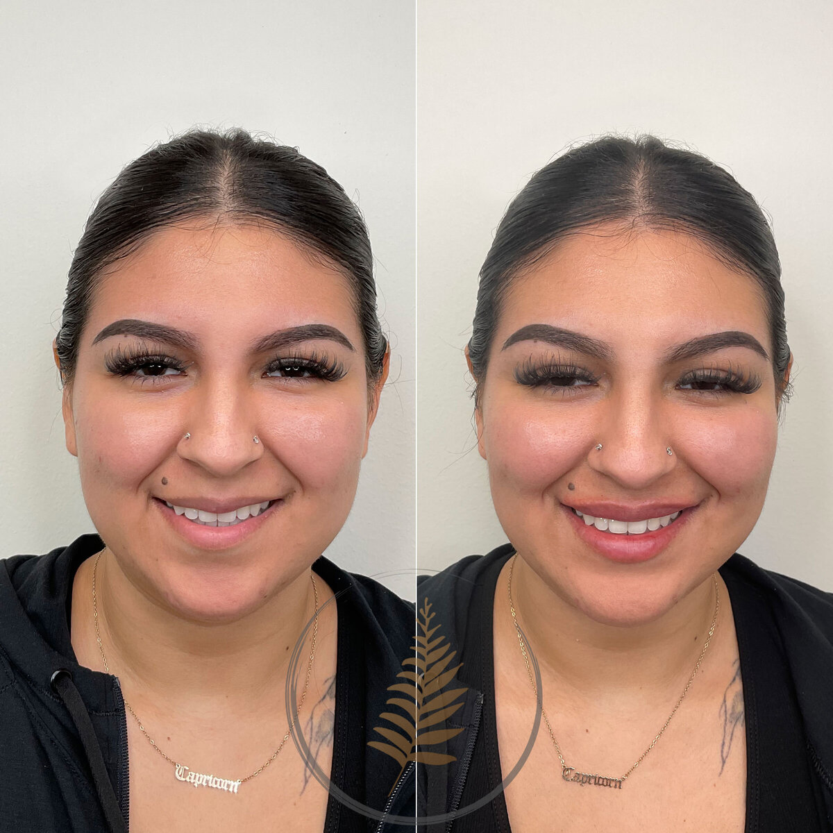FACESINBLOOM_BEFOREAFTER_LIPS_04
