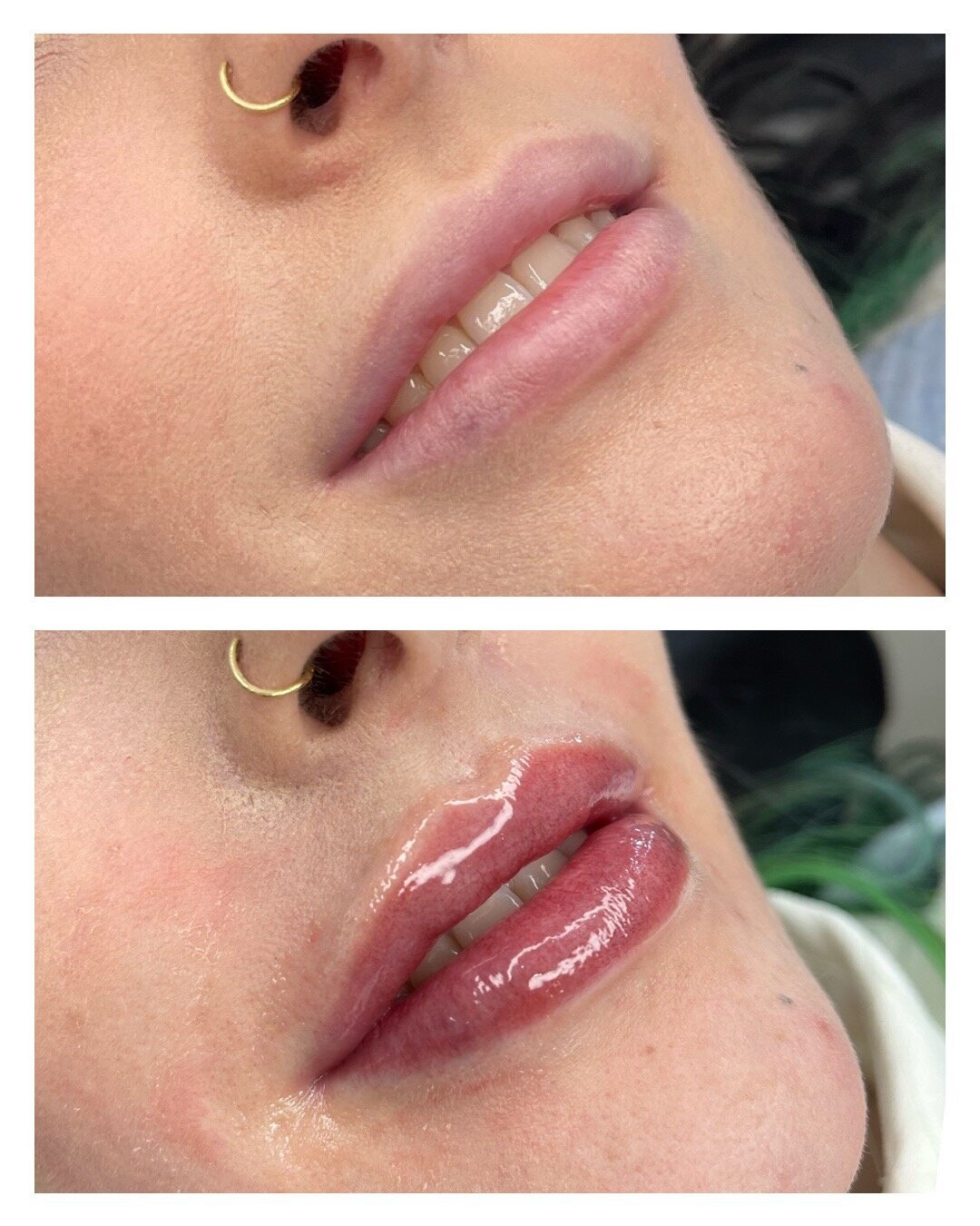 Lip Blush - BeforeAfter Karen