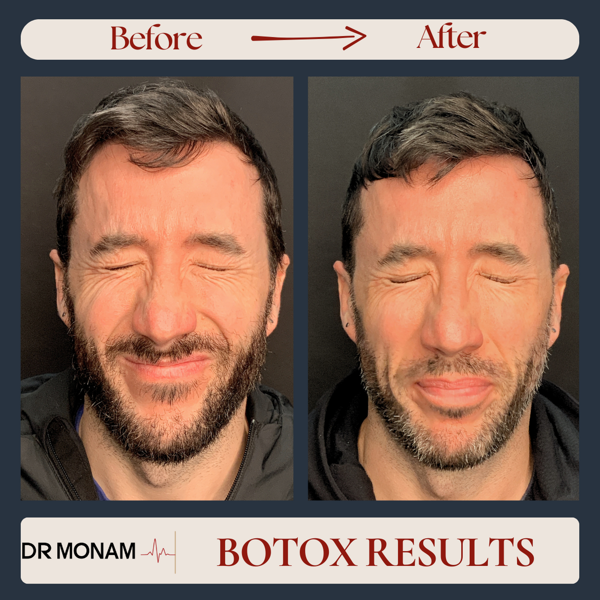 Neutral Before and After Instagram Post-9