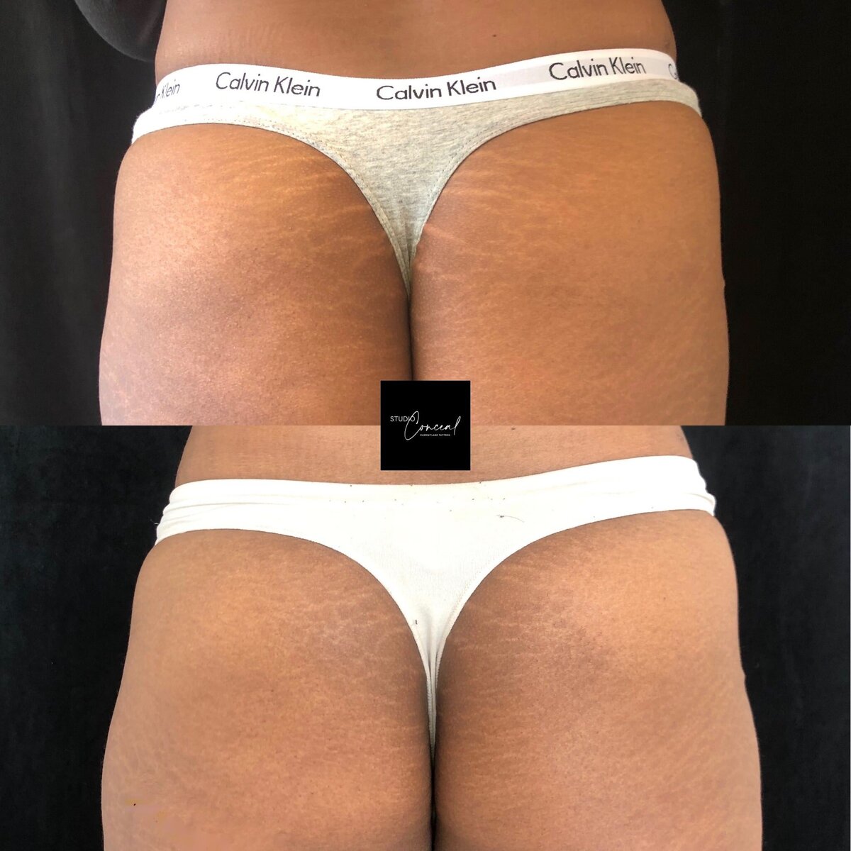 Dionne-Butt-2