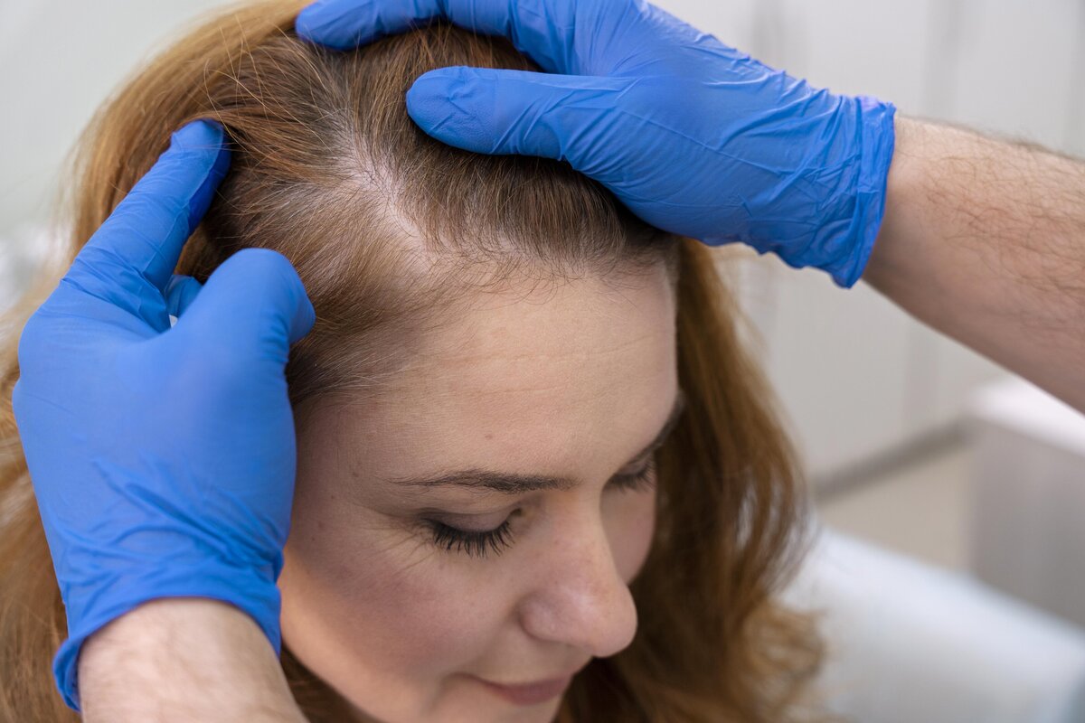Hair Restoration Skin by Dr Caroline (6)