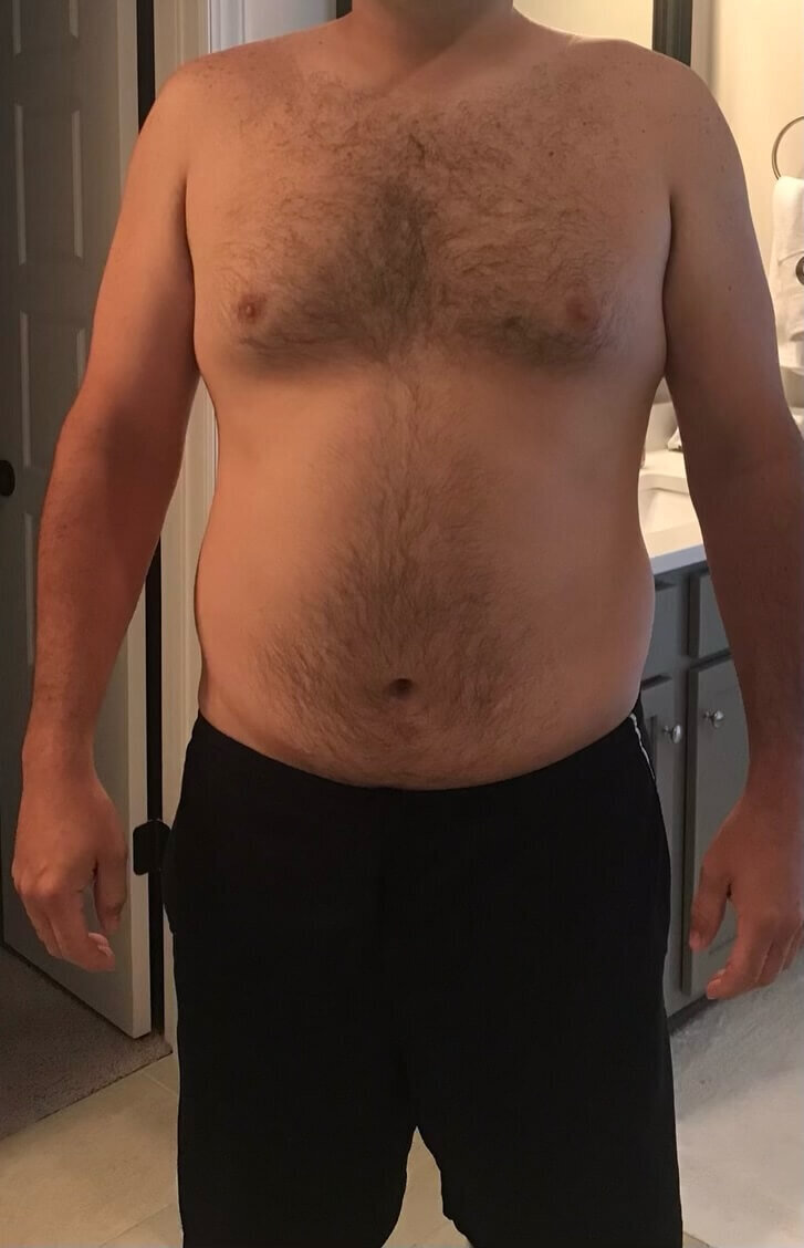 Before picture male_
