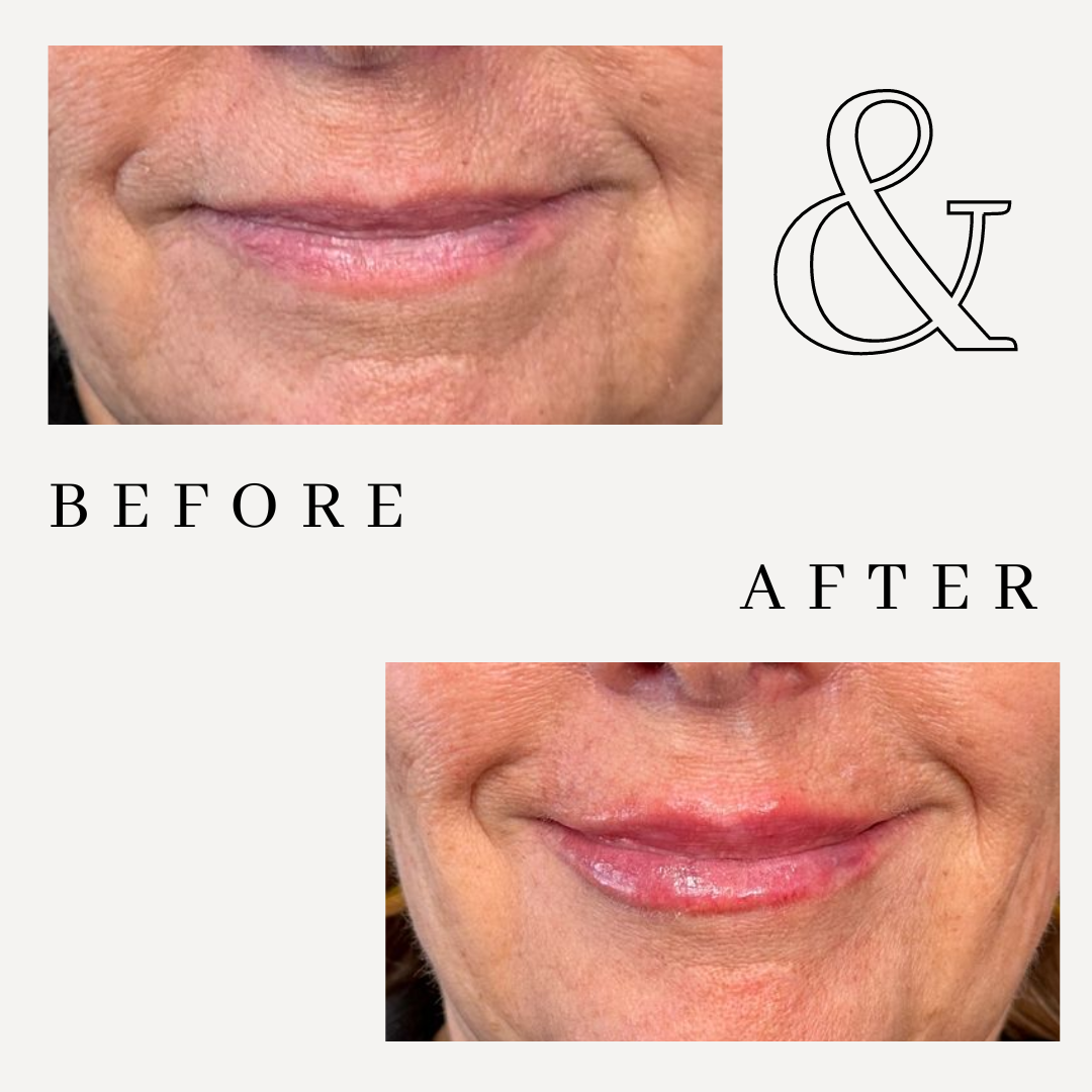 lips2