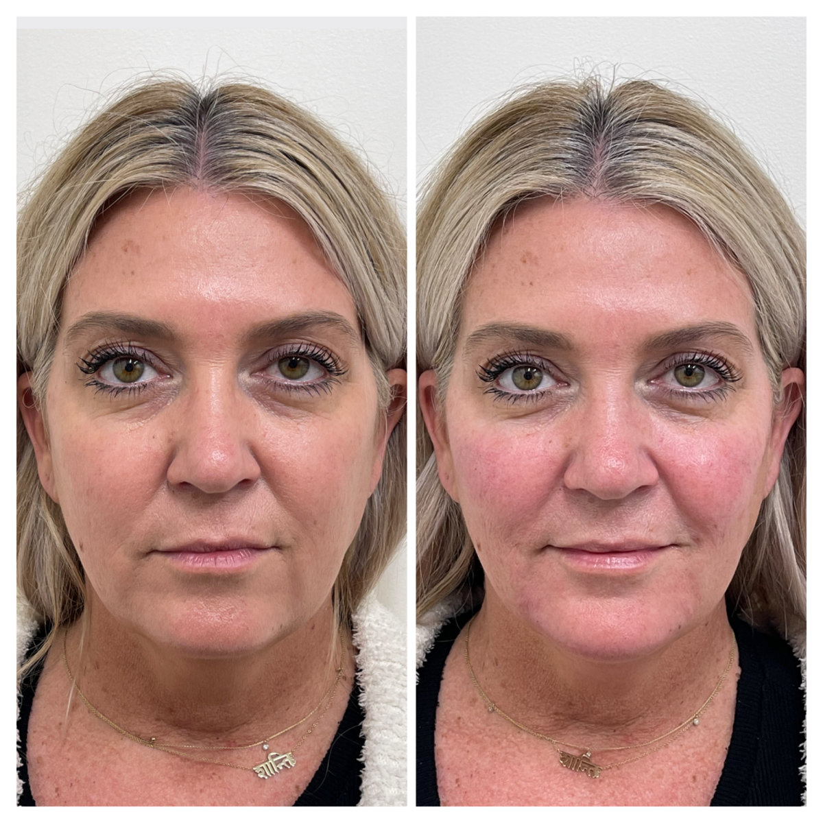 medspa north county san diego for natural results