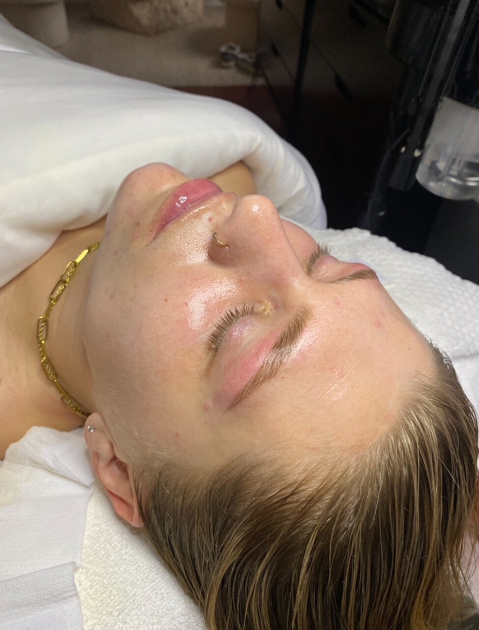 Brow 4