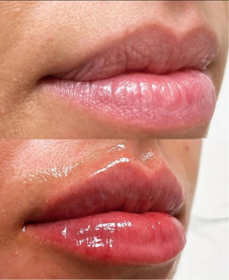 RMNY-beforeafter