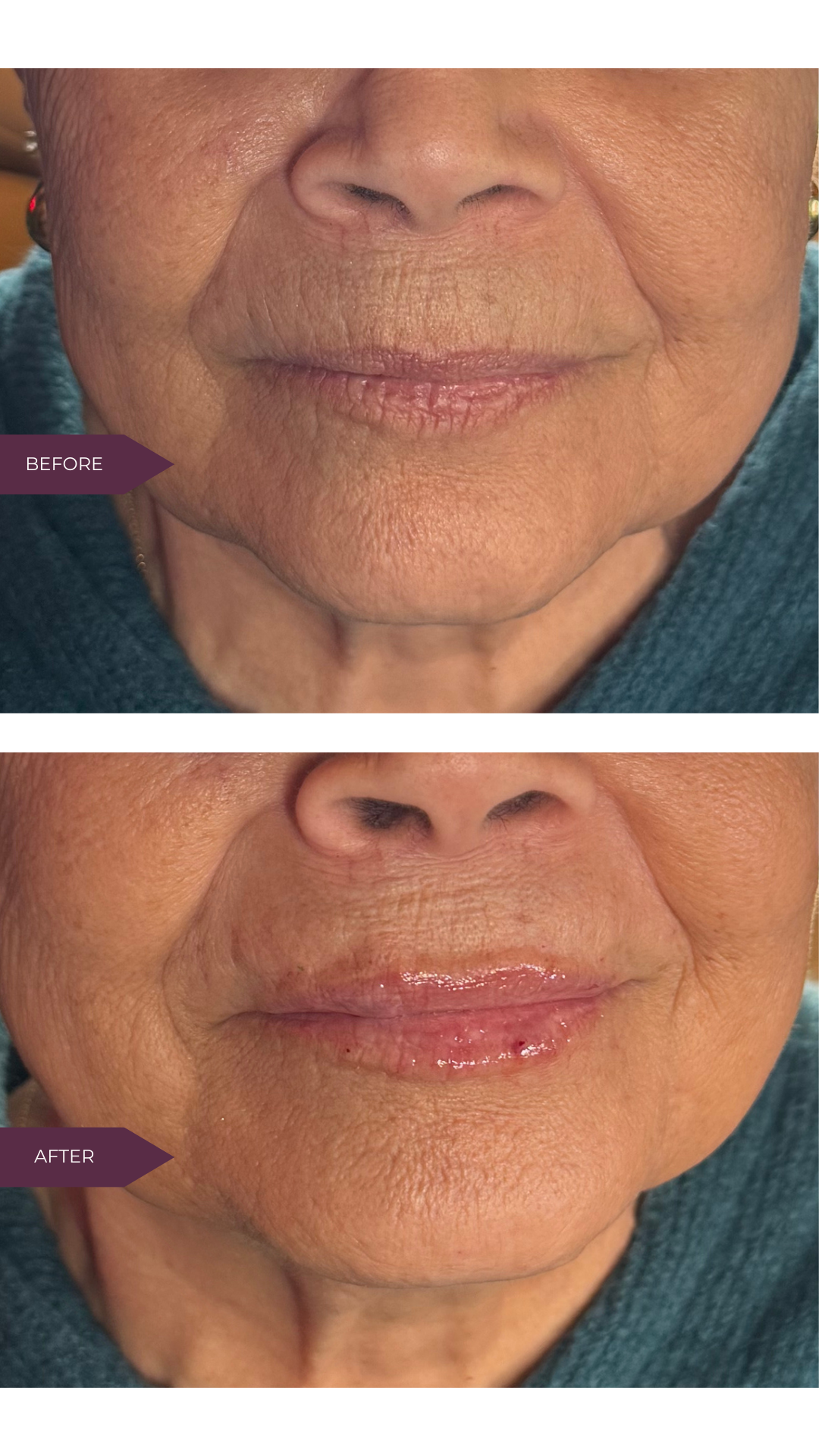 Copy of Before and Afters (Portrait Size).png 5