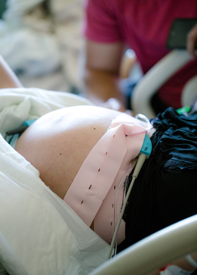 Heart monitor on a laboring mother's stomach. Photo by Diane Owen.