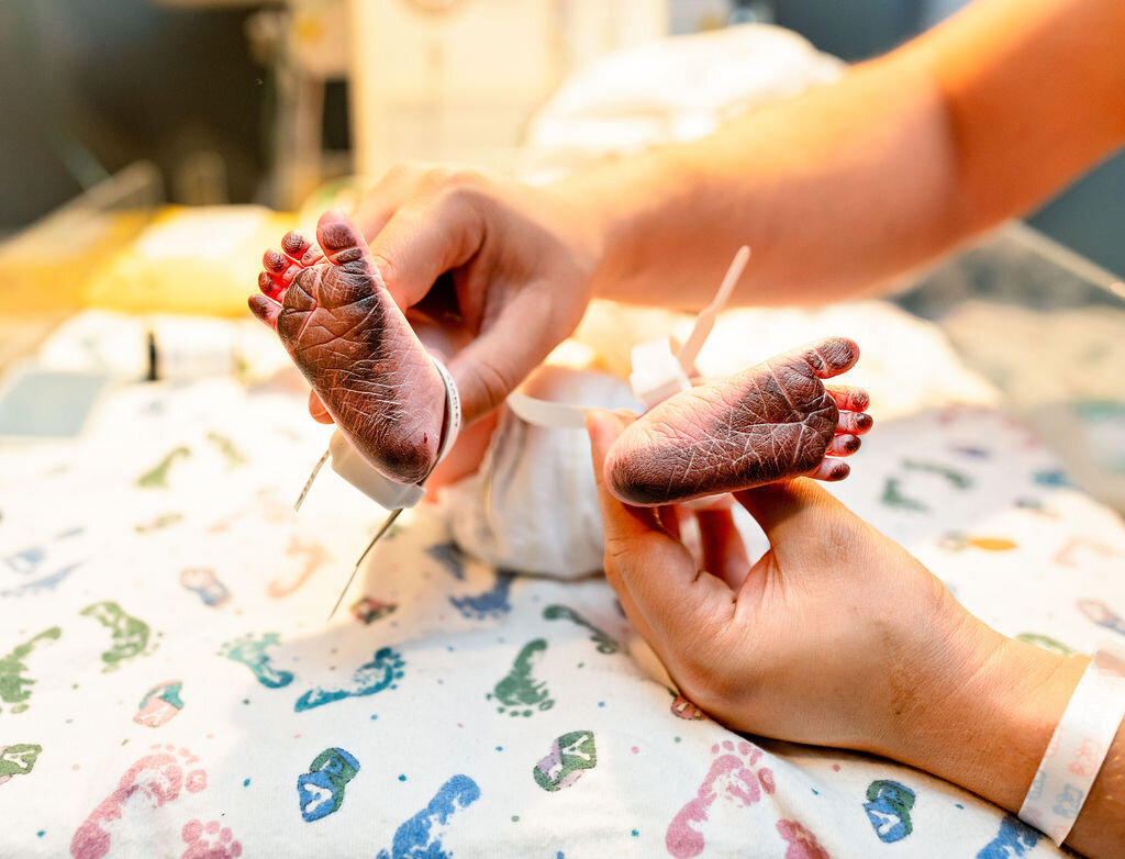 A nurse holds up a baby's feet, covered in black ink, after having footprints taken
