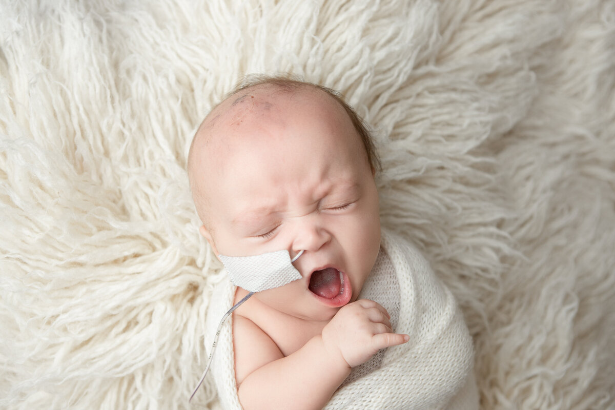 Older baby with a feeding tube on a bone flokati