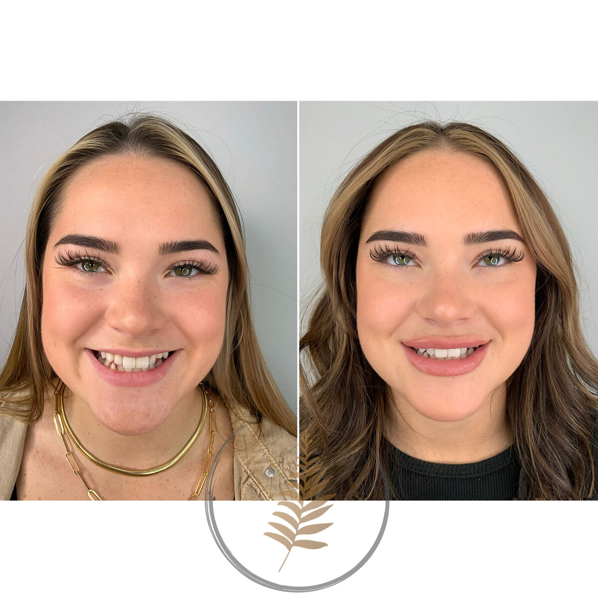 FACESINBLOOM_BEFOREAFTER_LIPS_03