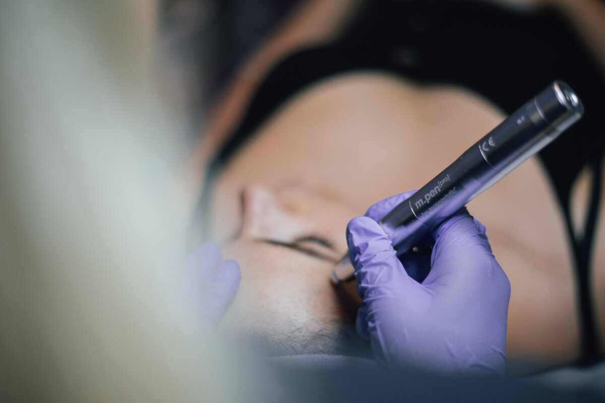 About - Mesoestetic microneedling at Missy's Beauty Nantwich
