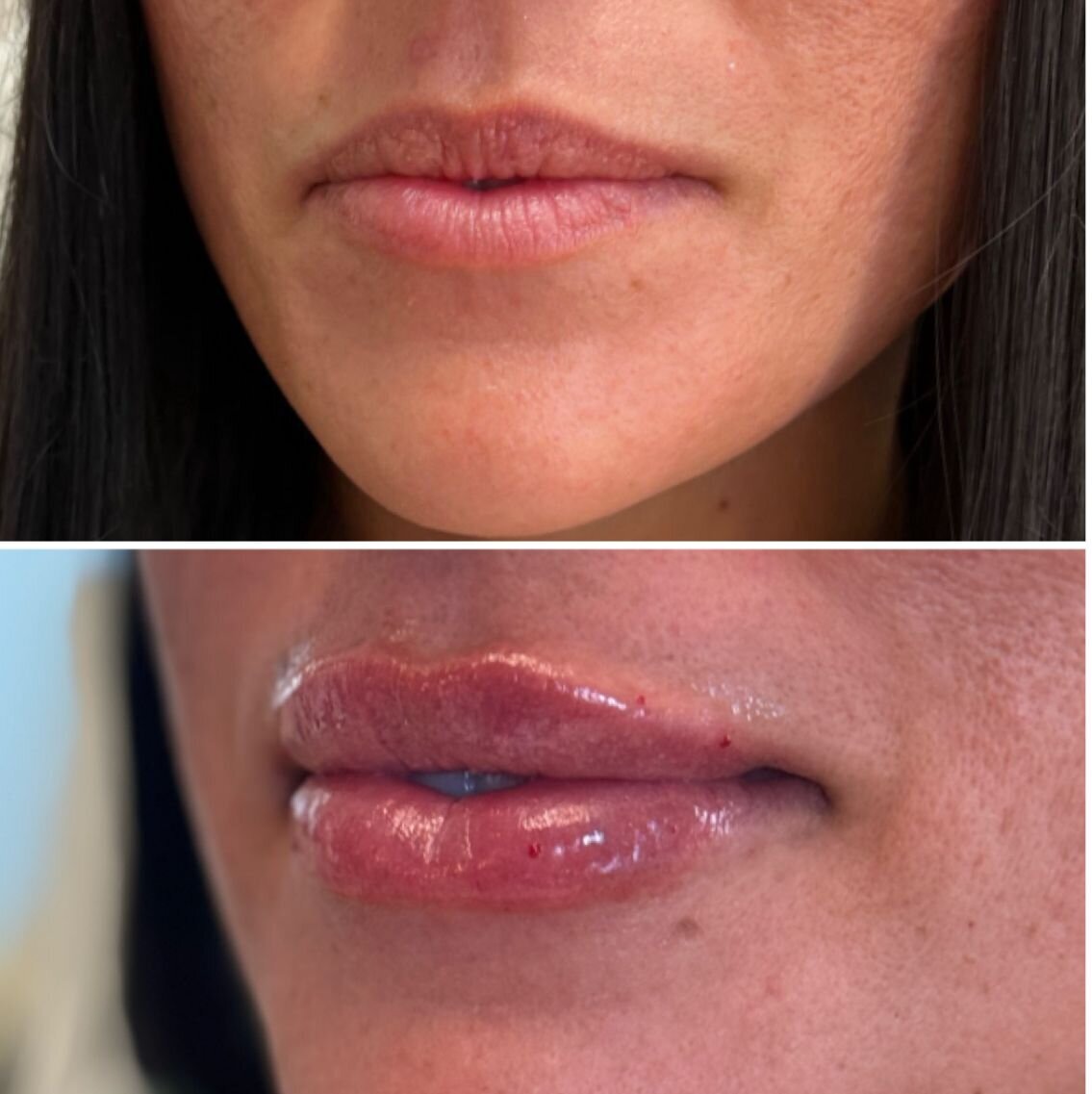 compressed-Lip-Wrinkles- Lip-volume-nd-some-brand-pics-31