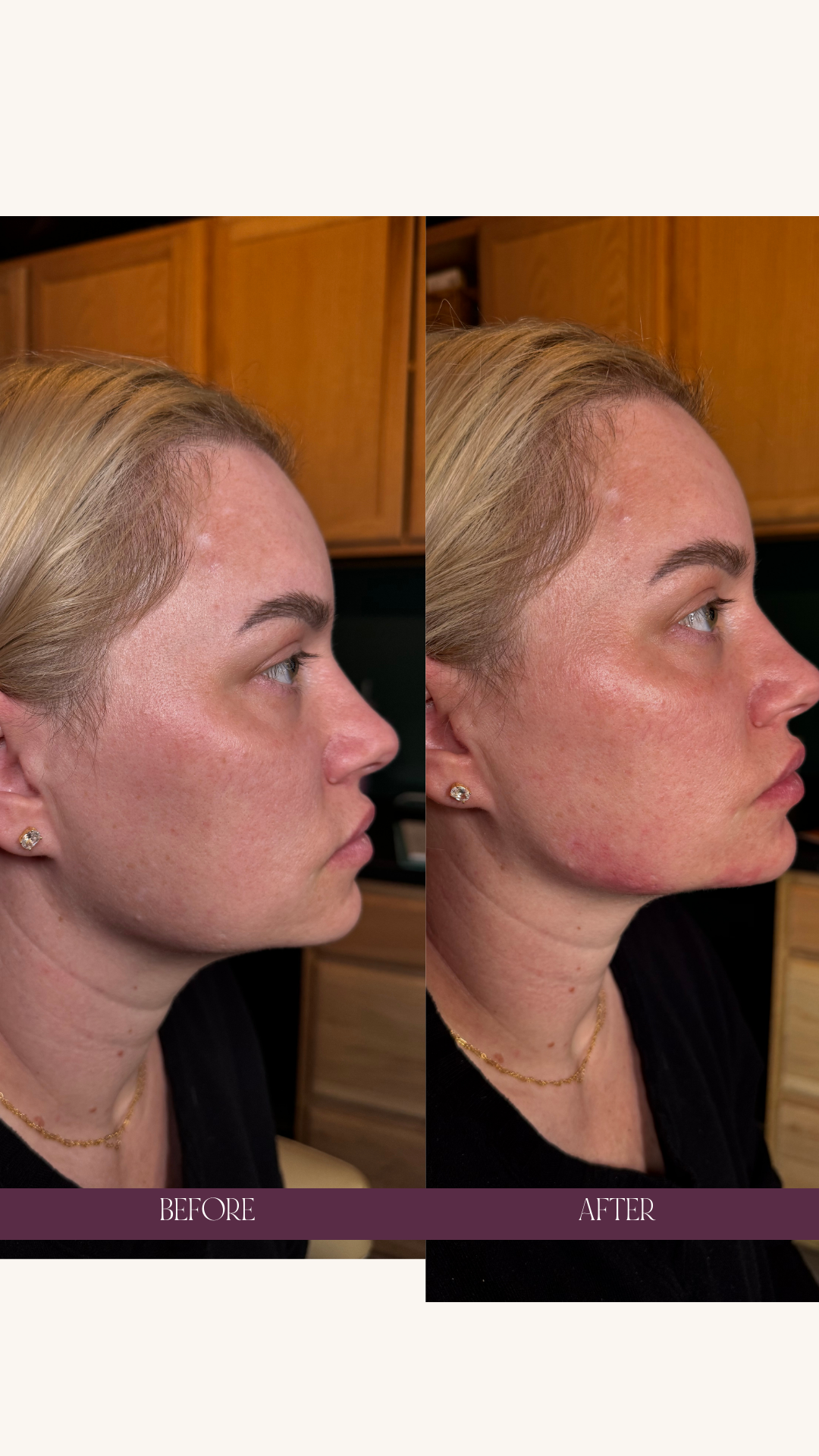 Copy of Before and Afters (Portrait Size).png 7