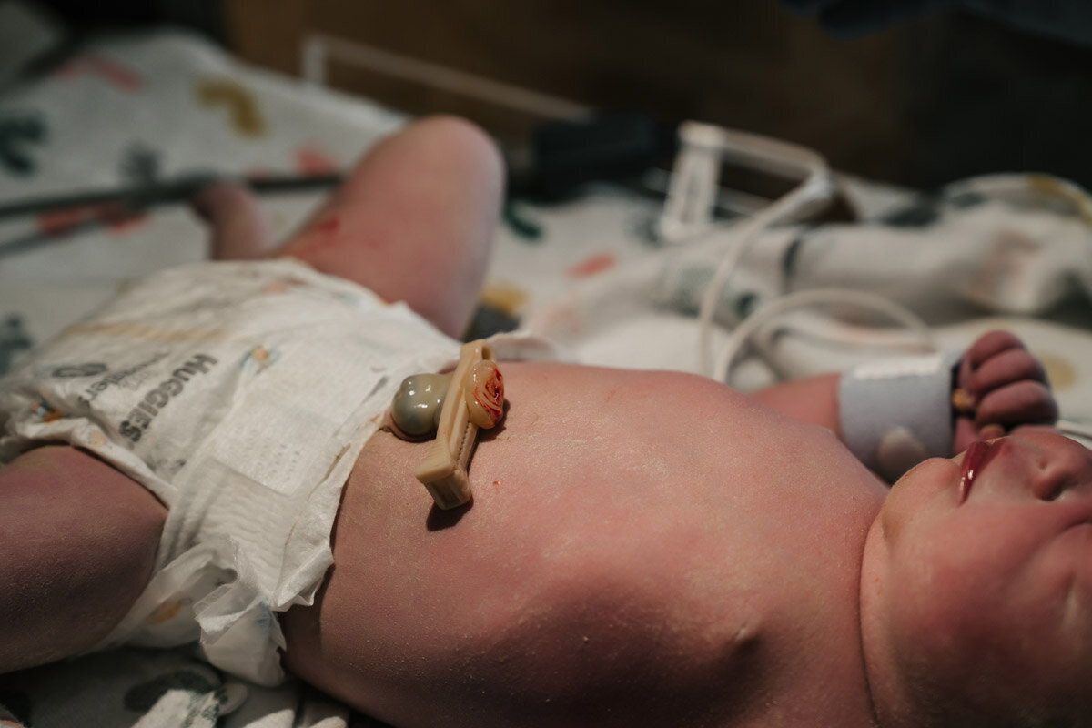 surrogate-hospital-birth-photography-e-024