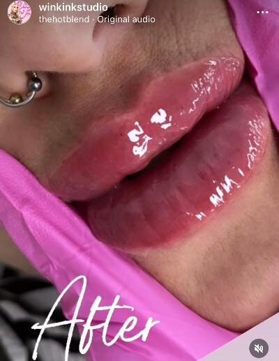 lip3