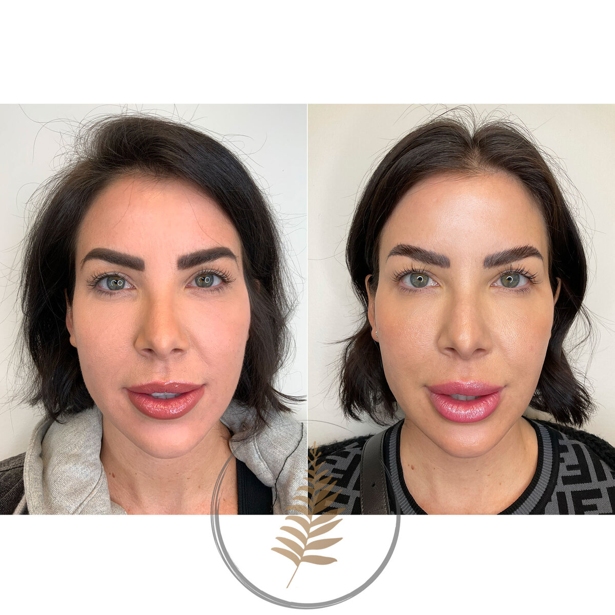 FACESINBLOOM_BEFOREAFTER_LIPS_10
