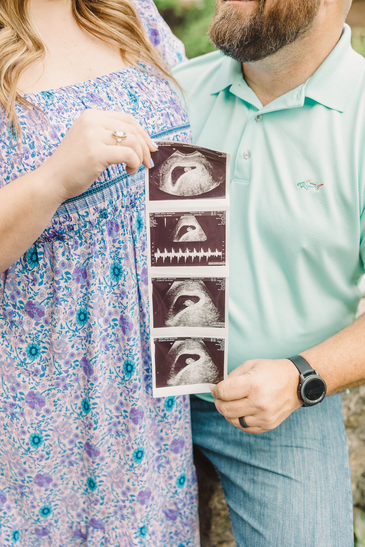 Pruitt Pregnancy Announcement (16 of 85)