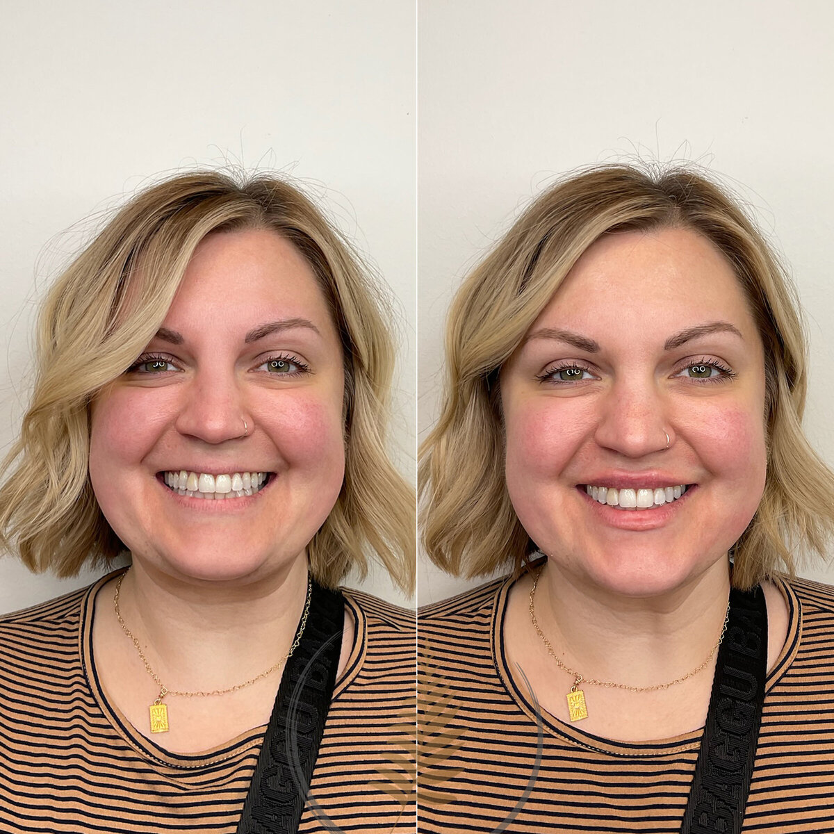 BEFORE:AFTER02 copy 2