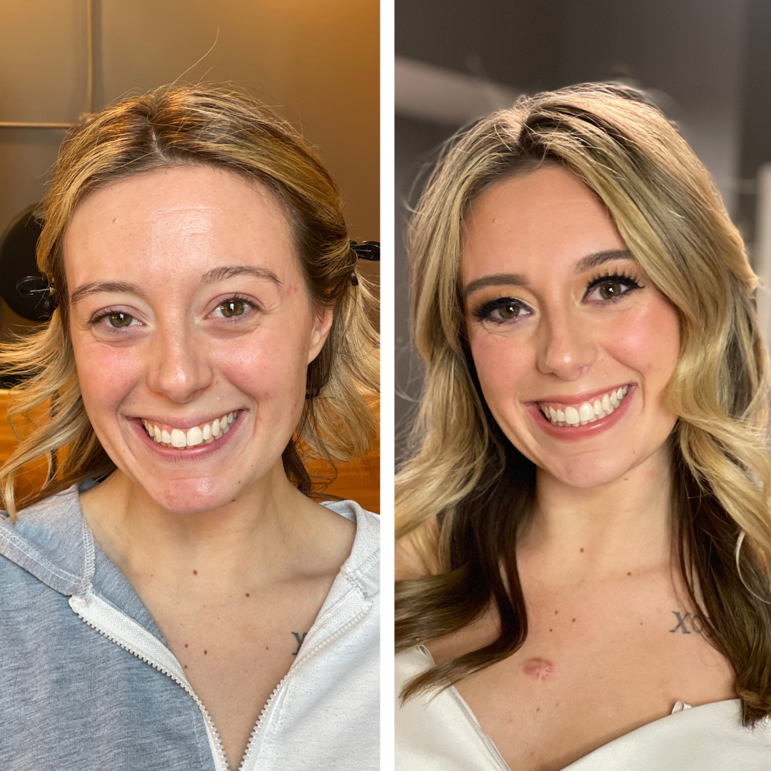 Simple Photo Before and After Skincare Instagram Post - 12