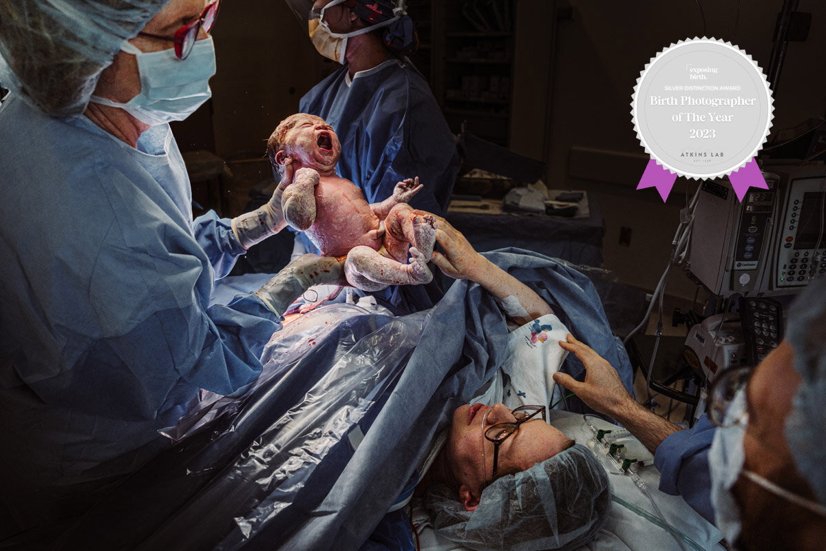 cesarean-birth-photography-natalie-broders-c-019