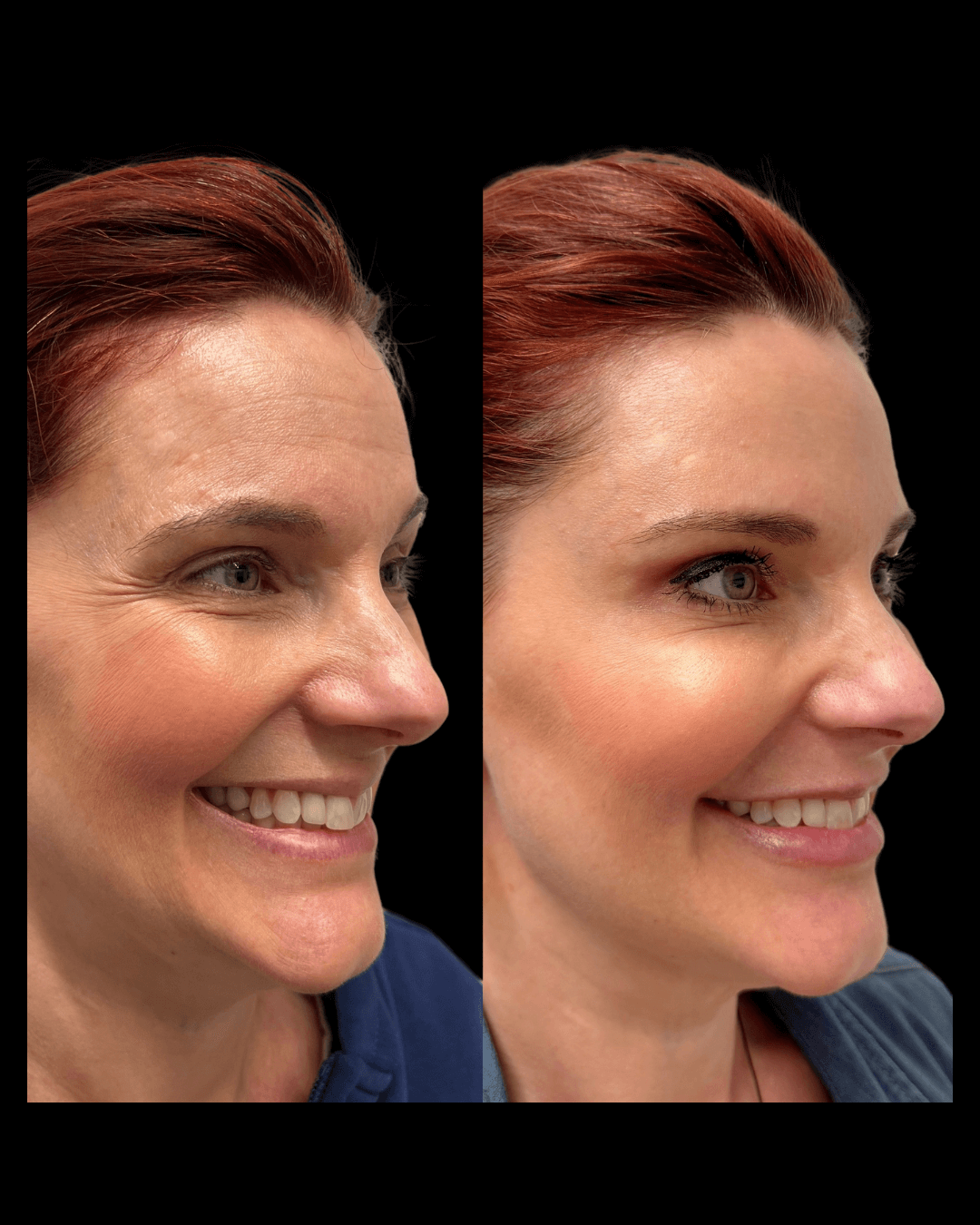 Maxwell-Aesthetics-Salem-Oregon-Results-28
