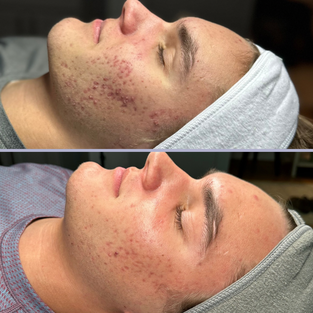 Joey h b&a - 2