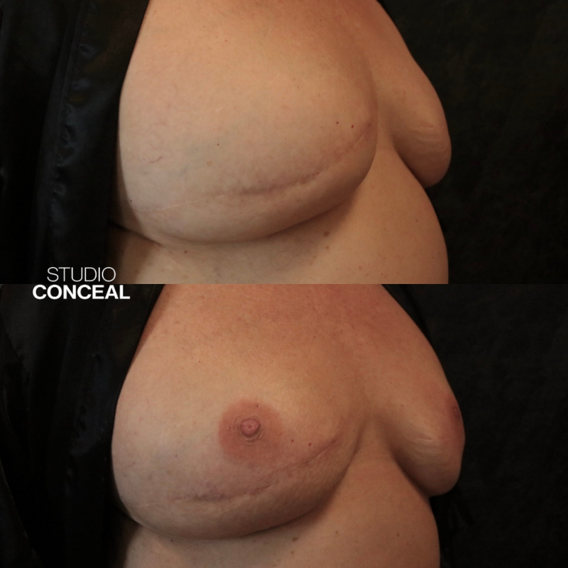 az_3d_areola tattoo_1
