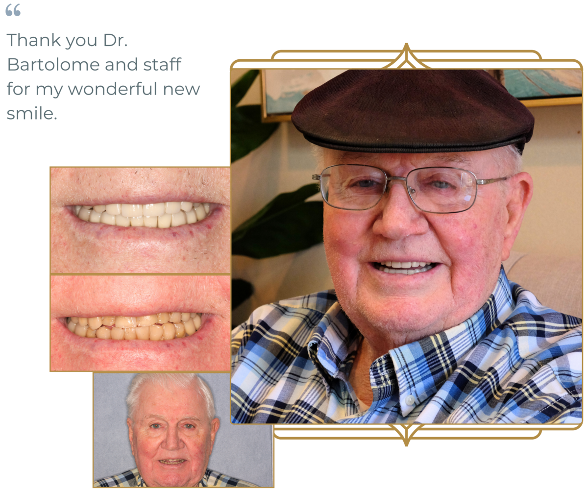 Sacramento-Smile-Makeover-10