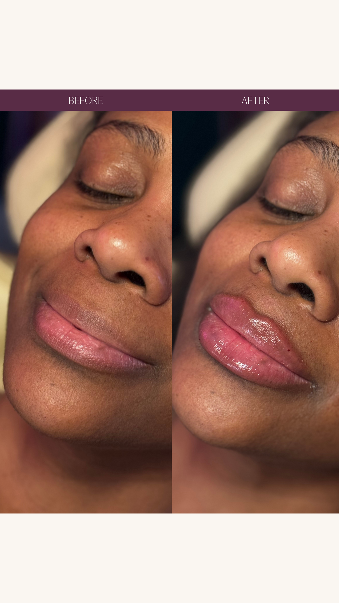 Copy of Before and Afters (Portrait Size).png 1