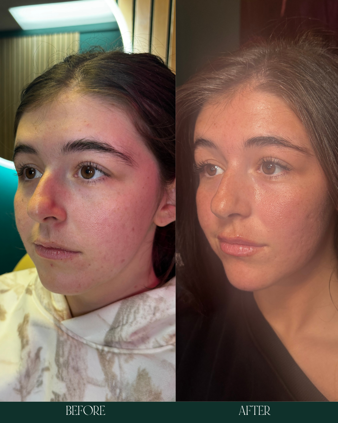 Copy of Before and Afters (Portrait Size).zip - 4