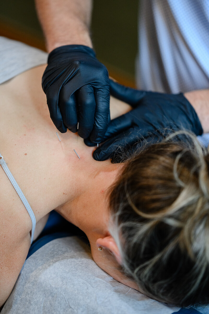 A branding photographer and brand photographer takes a picture of a chiropractor with gloves on doing dry needling on the back of the neck on a blonde woman during a brand photography session for brand photos and branding pictures.