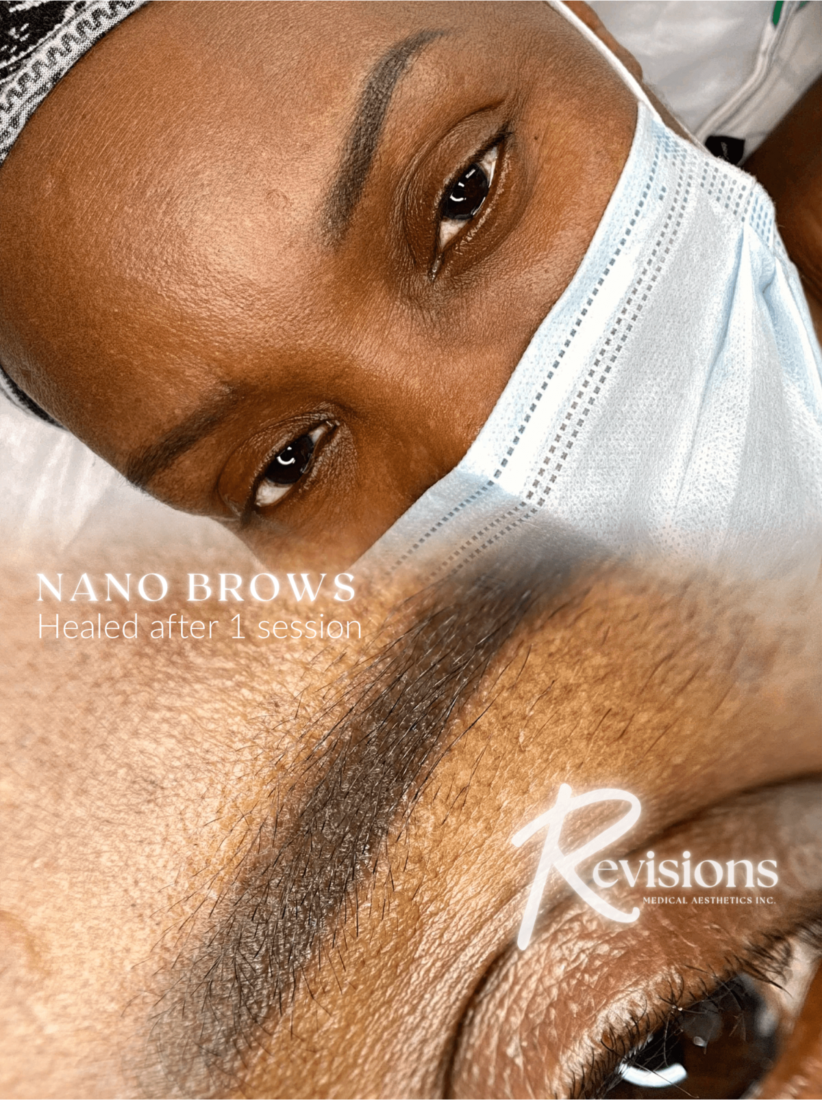 Best Nano Brows and Powder Brows for Dark Skin in Ottawa (1)