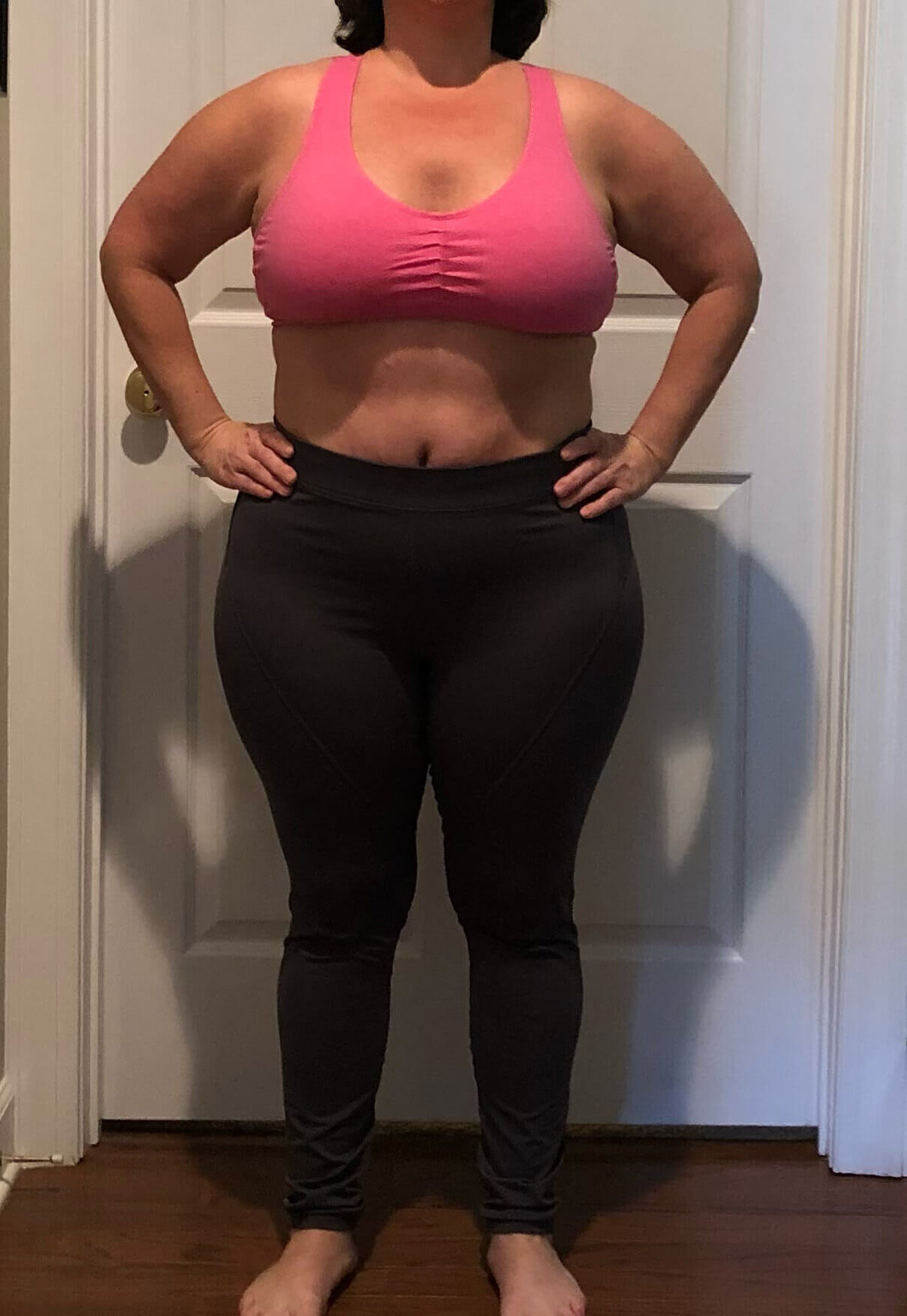 WeightLossTransformation_Before