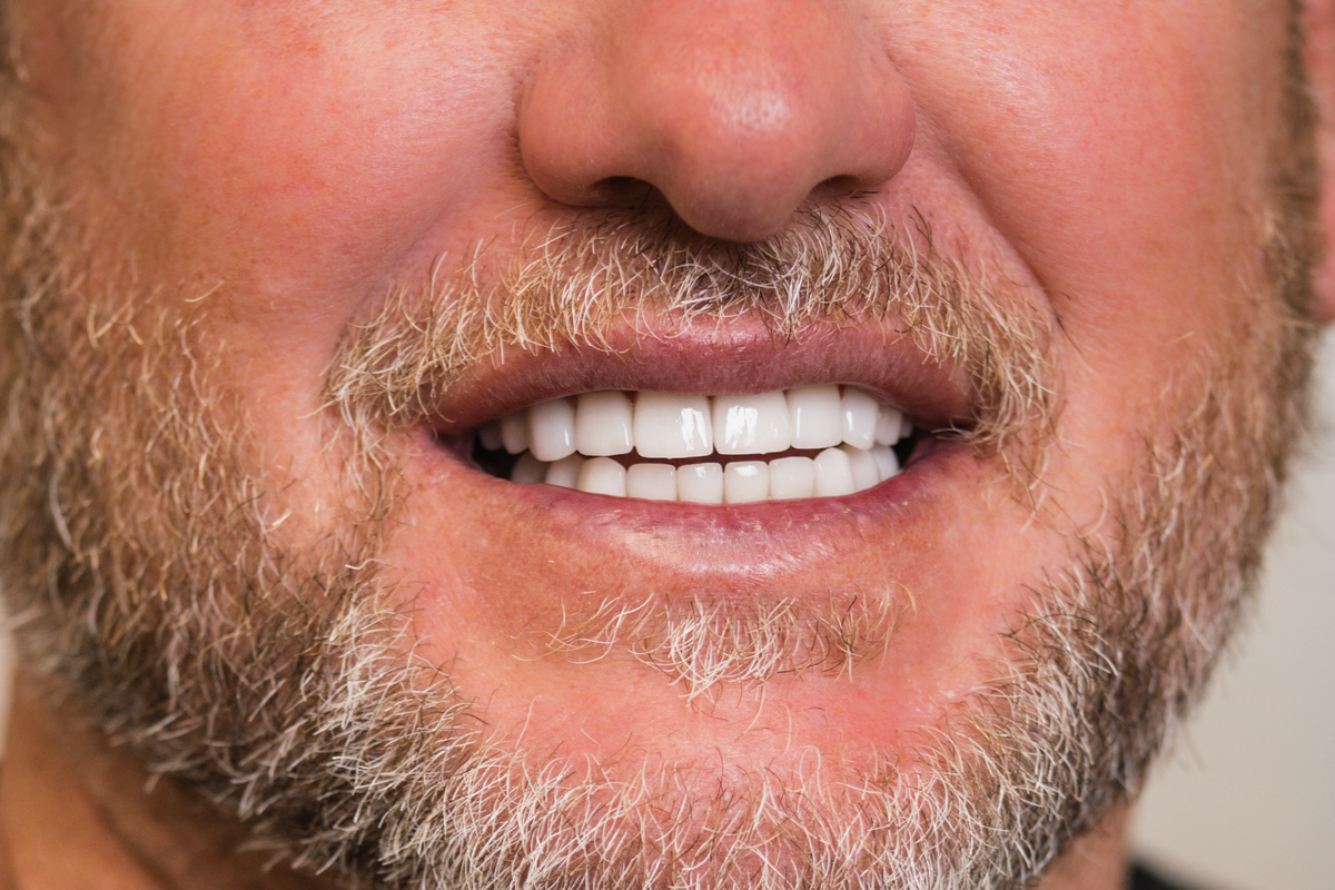 Jones Dentistry March 2025-87
