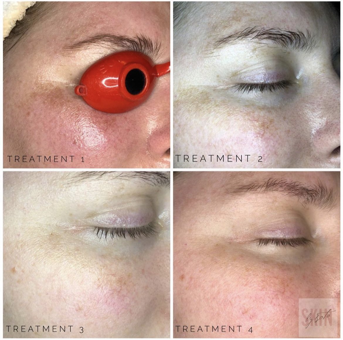 orange peel brightening boost