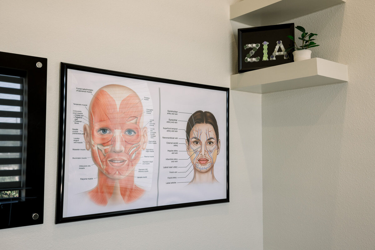 Zia0158