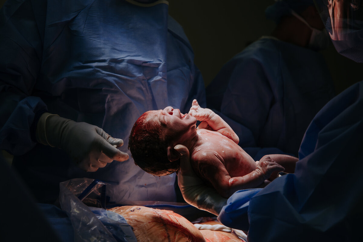 Docter holding baby born via C-Section in OR