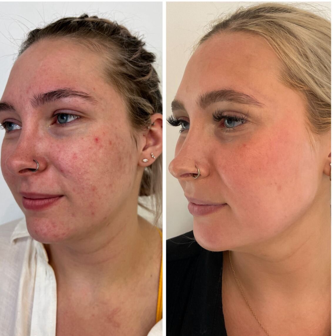 compressed-halo-before-after-08