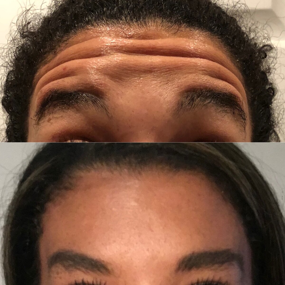 BalancedBeautyBotoxWestwood29